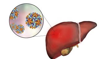 乙肝携带者会传染吗 乙肝携带者会传染吗